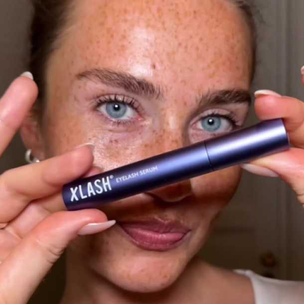 Inicio - Xlash