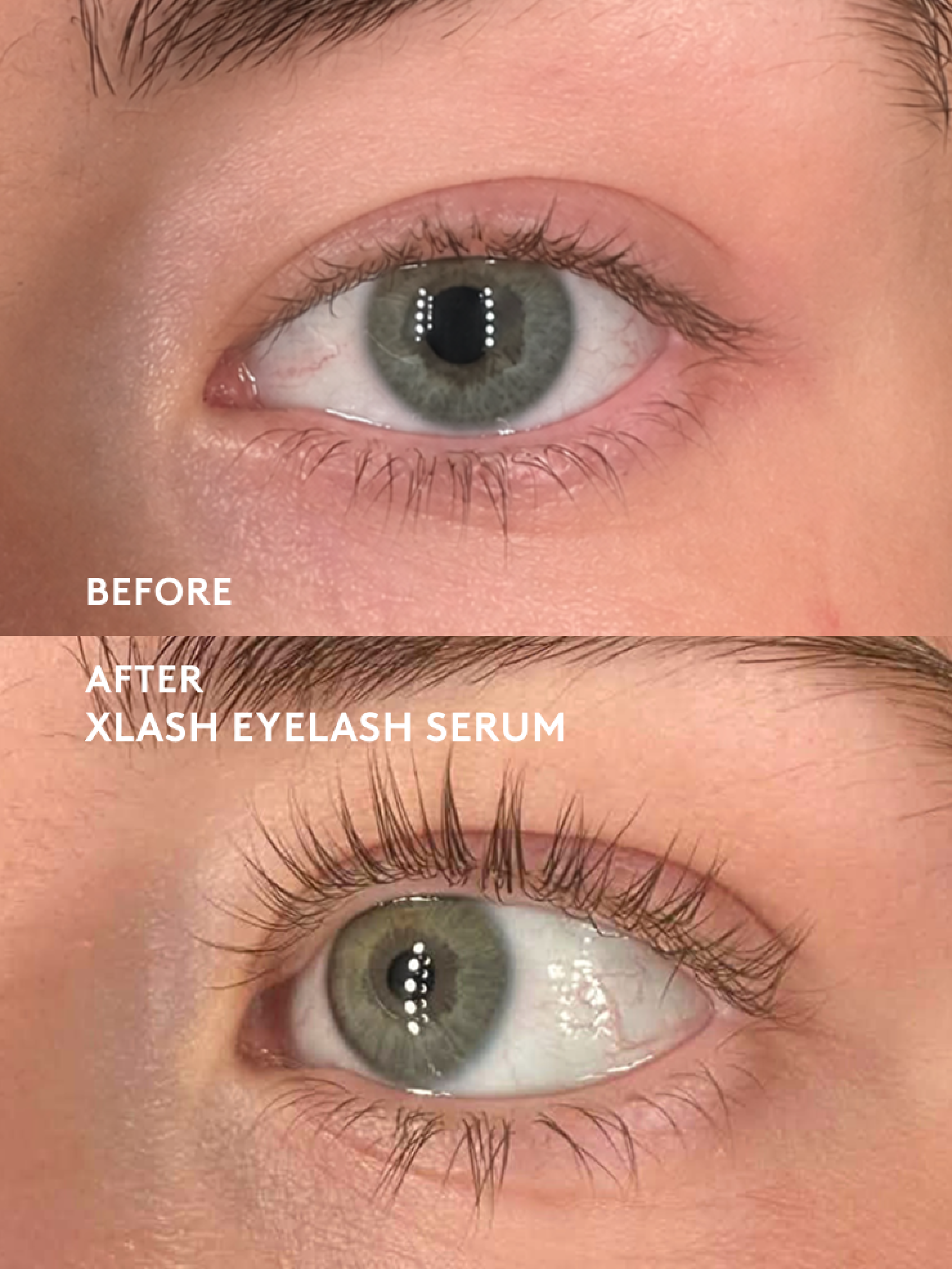 Xlash 5ml Serum Crece Pestañas - Xlash