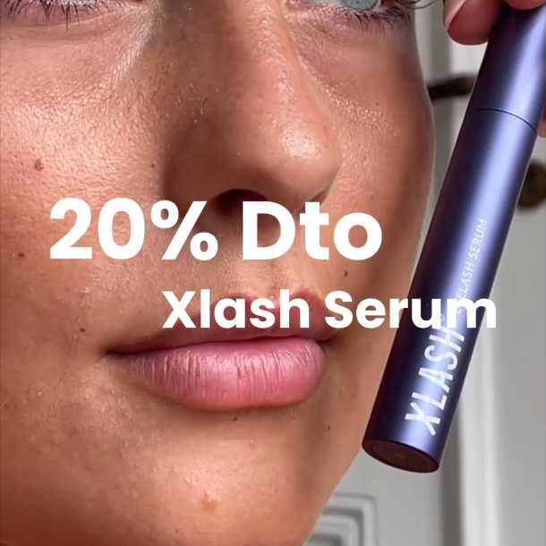 Inicio - Xlash