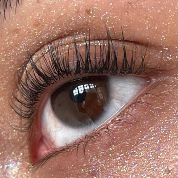 Inicio - Xlash