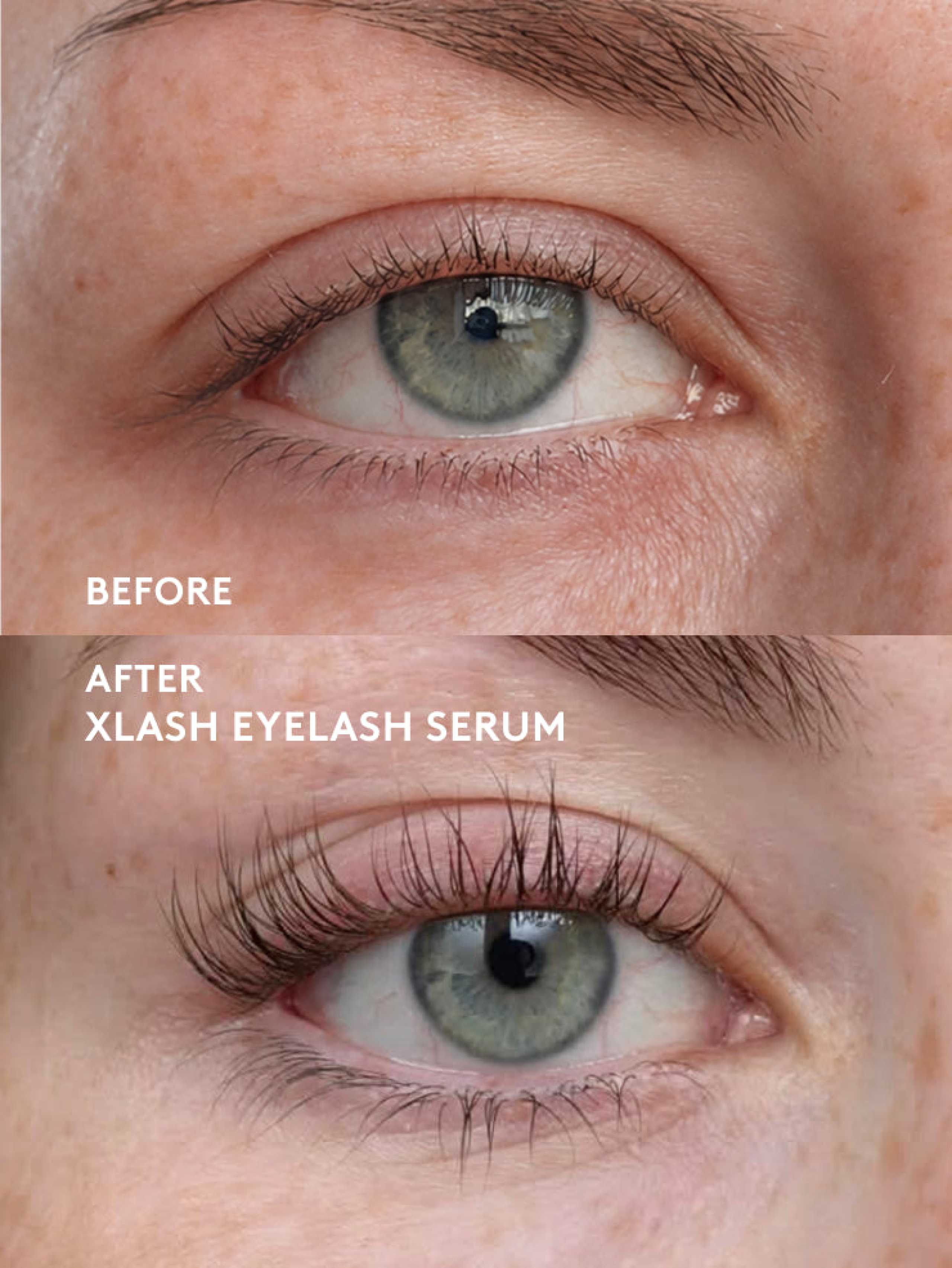 Xlash Serum Crece Pestañas 3ml - Xlash