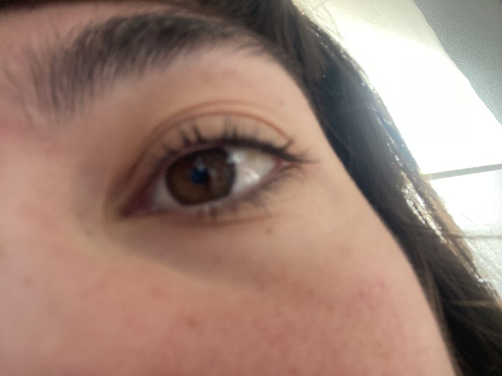 Imagen #1 de Anónimo