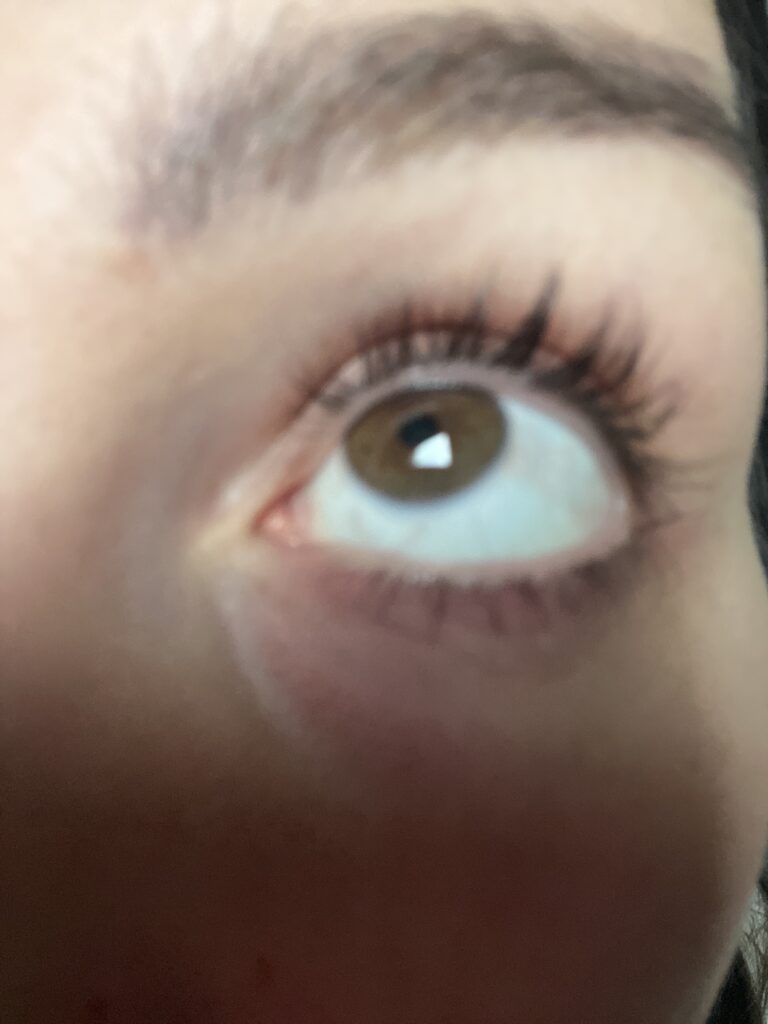 Imagen #1 de Anónimo