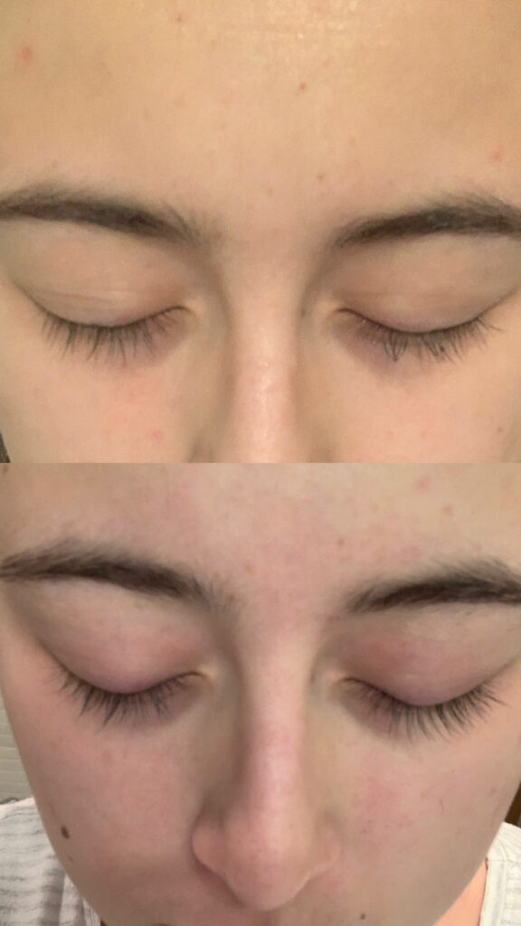 Imagen #1 de Anónimo