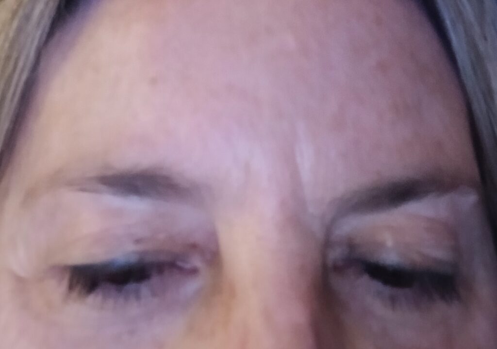 Imagen #1 de Anónimo